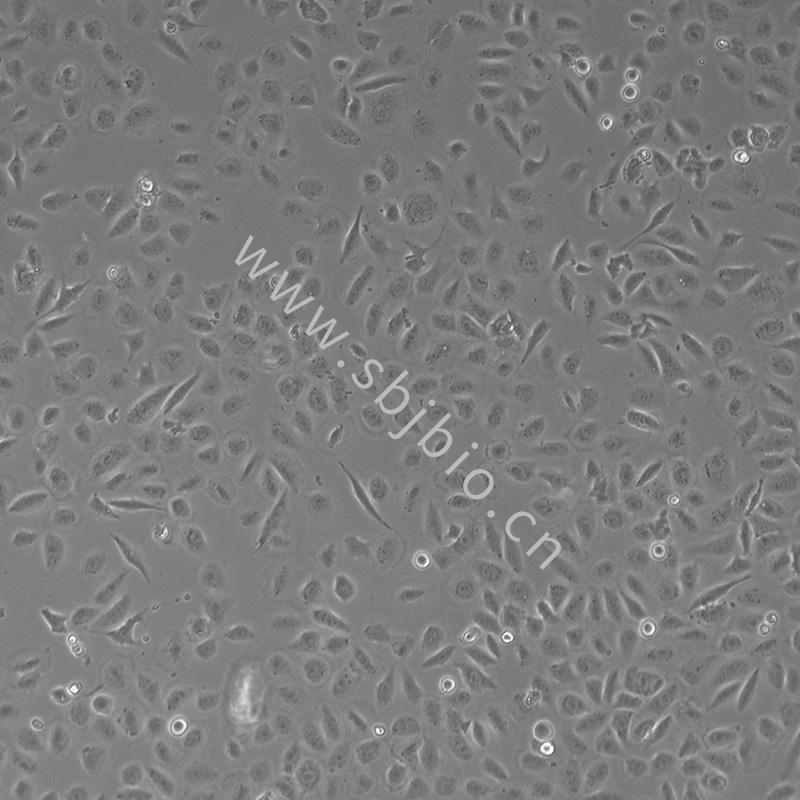 人支氣管上皮樣細胞16HBE（ HBE135-E6E7）