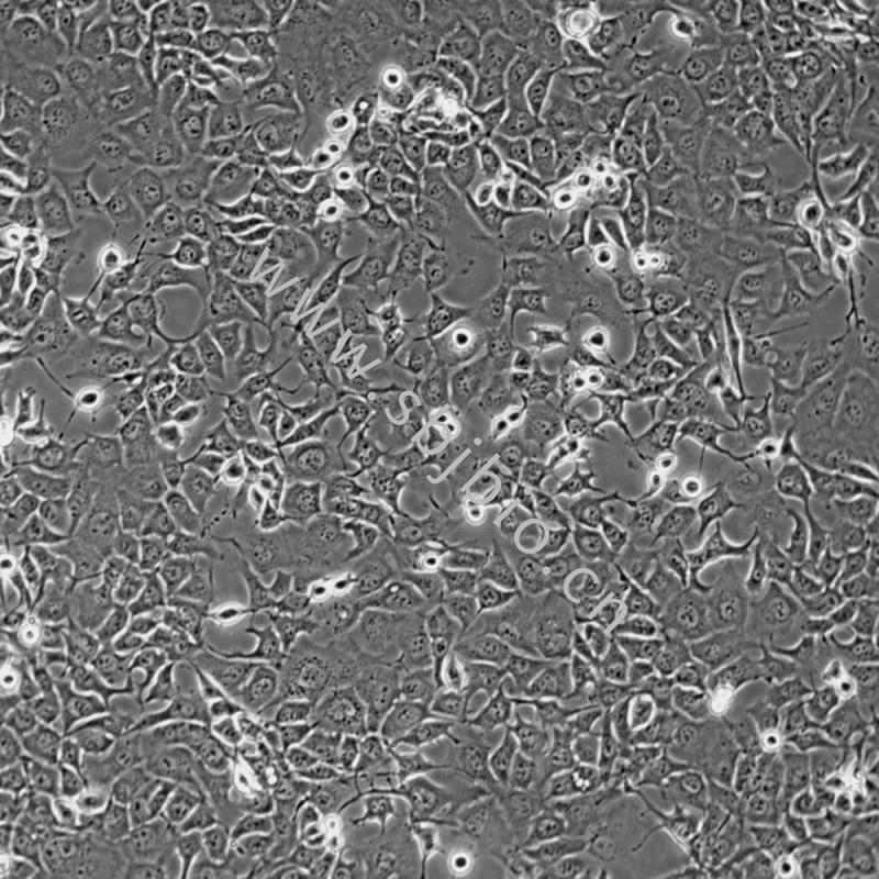 人肺腺癌細(xì)胞（NCI-H1975）