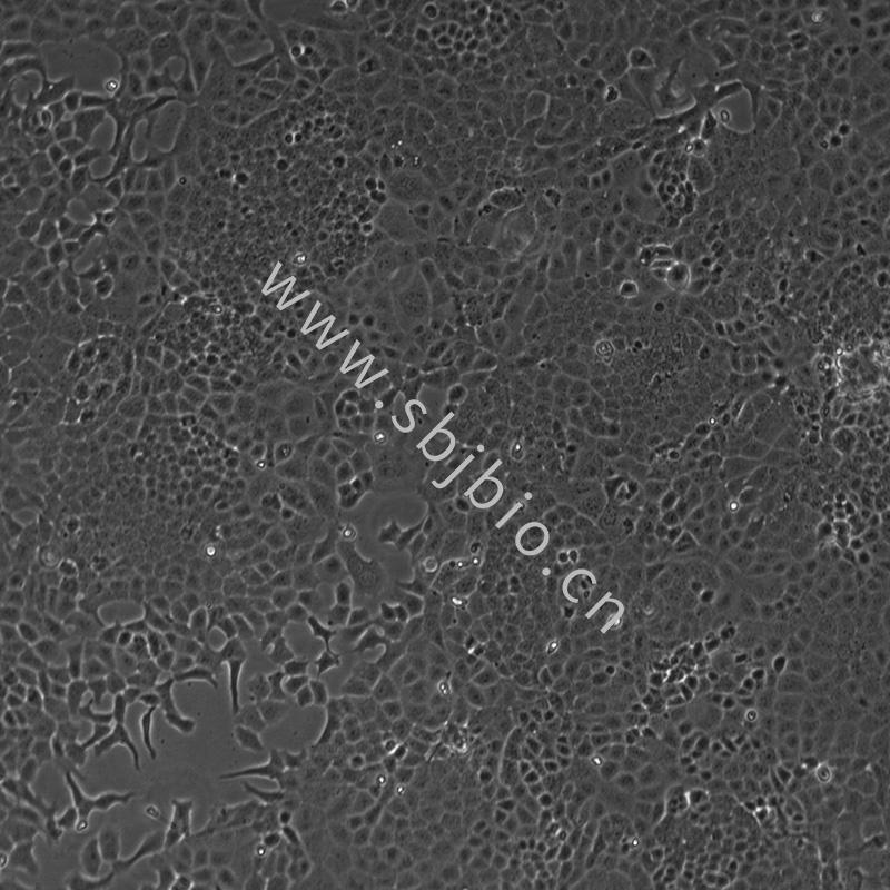 小鼠肺上皮細(xì)胞MLE-12